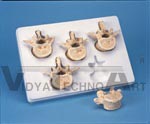 Set of 5 Lumbar Vertebrae